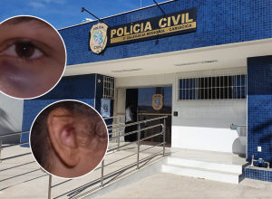Mulher-gravida-e-agredida-em-Vila-Velha-Foto-TV-Vitoria-Reproducao-.png